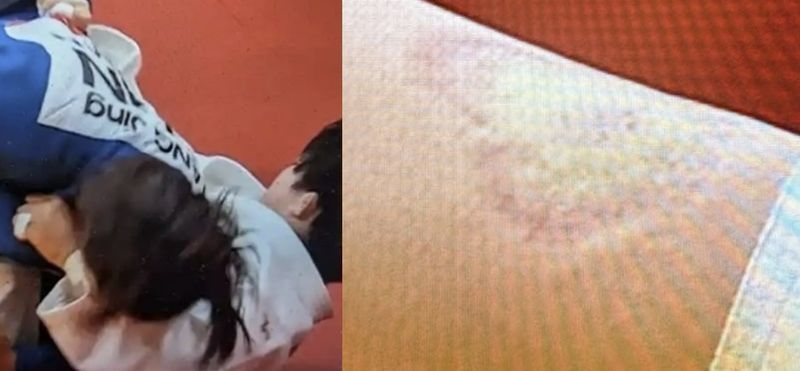 중국 여자 유도 국가대표 탕징은 지난 1일 일본 나고야 아이치 인터내셔널 아레나에서 열린 대회 유도 여자 70㎏급 8강에서 상대 선수인 일본 마에다 린의 팔을 깨물어 반칙패를 당했다. 출처=SNS캡쳐