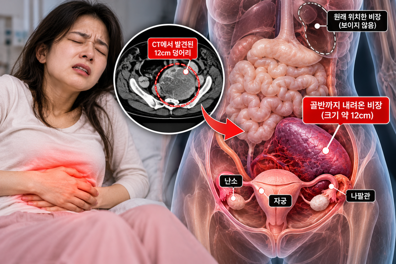 기사의 이해를 돕기 위한 AI 이미지입니다