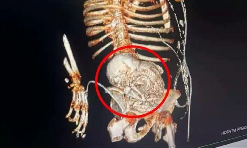 자료사진